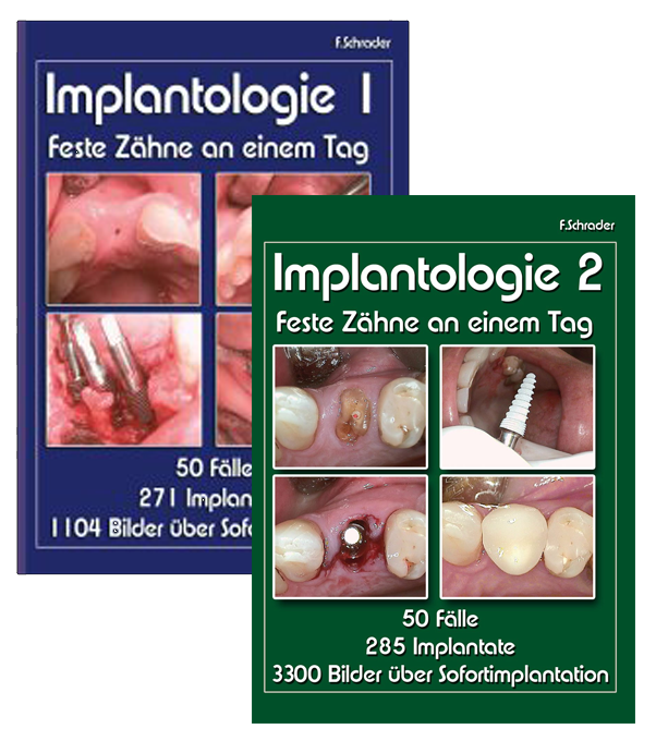 Implantologie2